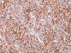 CD44 Antibody (SPM521), Novus Biologicals 0.2mg; Unlabeled:Antibodies,
